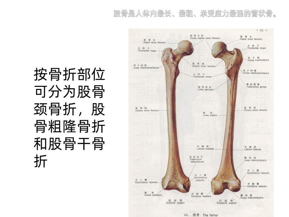 股骨骨折护理ppt课件1.ppt_第3页