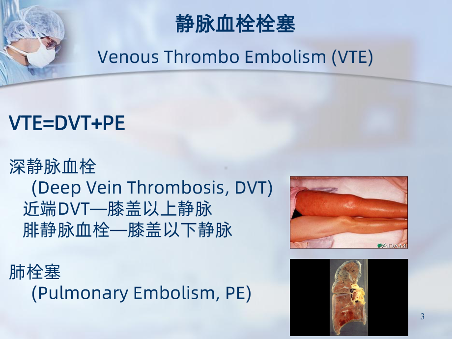 骨科深静脉血栓的预防PPT课件.ppt_第3页