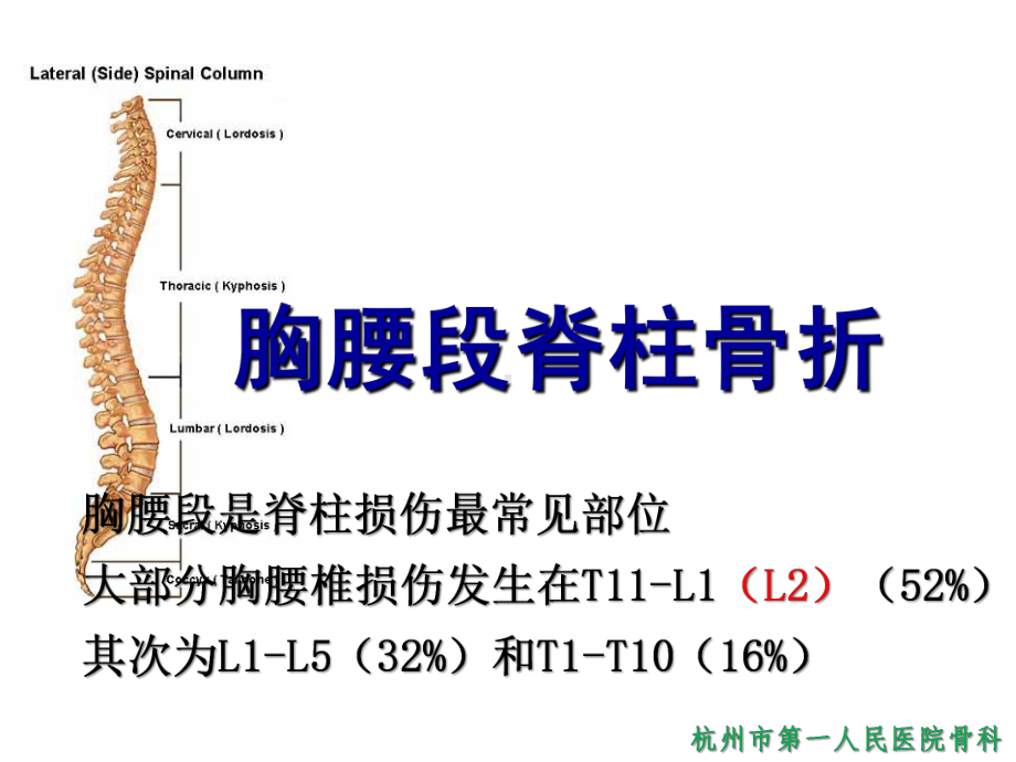 胸腰段脊柱骨折课件.ppt_第2页