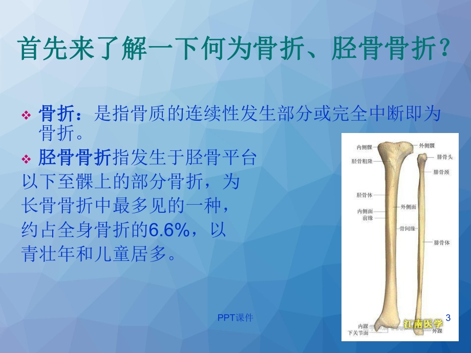 胫骨骨折的护理查房-ppt课件.ppt_第3页