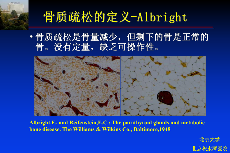 骨质疏松症的影像学诊断课件.ppt_第2页