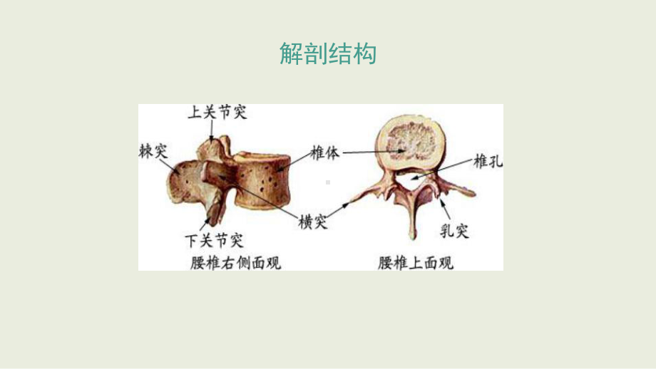 腰椎骨折护理查房课件.pptx_第3页