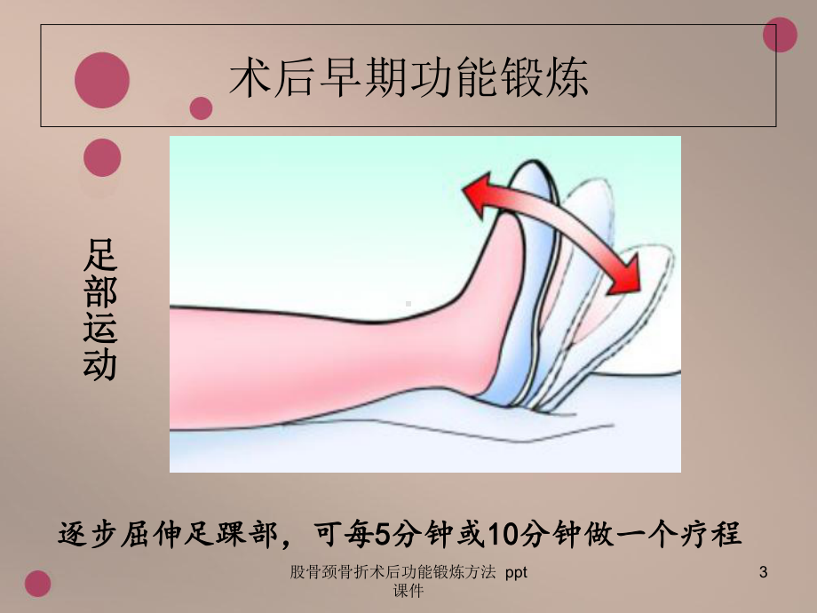 股骨颈骨折术后功能锻炼方法-ppt课件.ppt_第3页