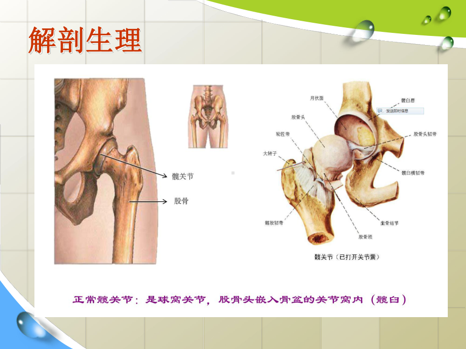 股骨头置换术后护理查房.课件.ppt_第3页