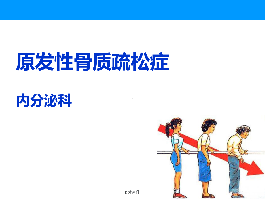 骨质疏松症（内分泌科）-ppt课件.ppt_第1页