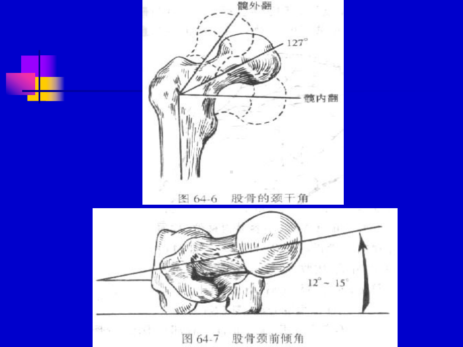 下肢骨折牵引图课件.ppt_第3页