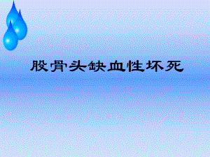 浅谈股骨头缺血性坏死护理查房课件.ppt