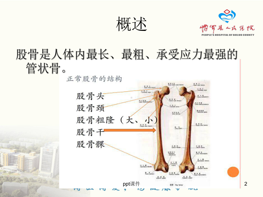 股骨骨折的健康宣教-ppt课件.ppt_第2页