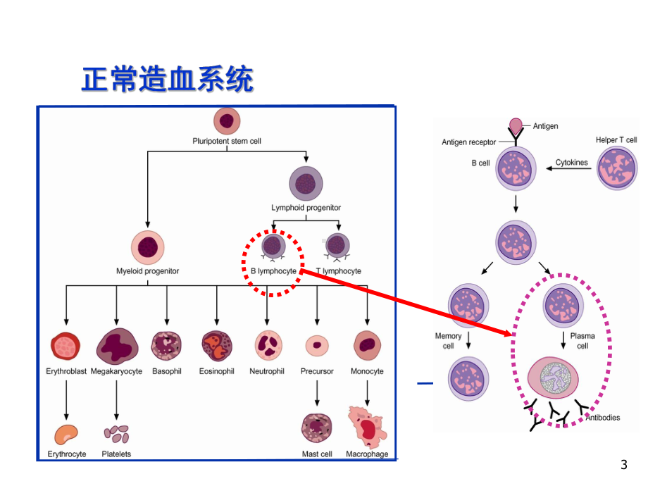 多发性骨髓瘤-PPT课件.ppt_第3页