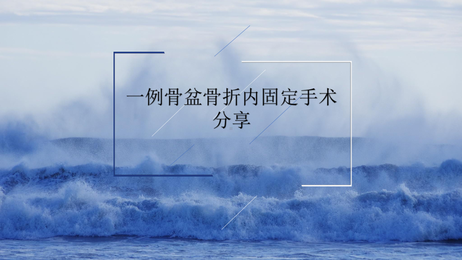 骨盆骨折手术配合PPT课件.ppt_第1页