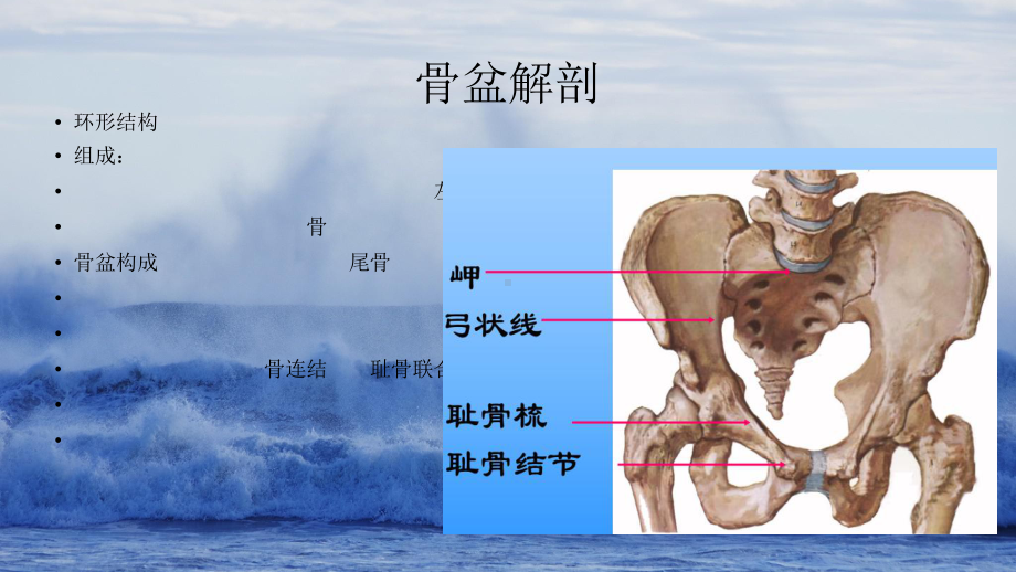 骨盆骨折手术配合PPT课件.ppt_第2页