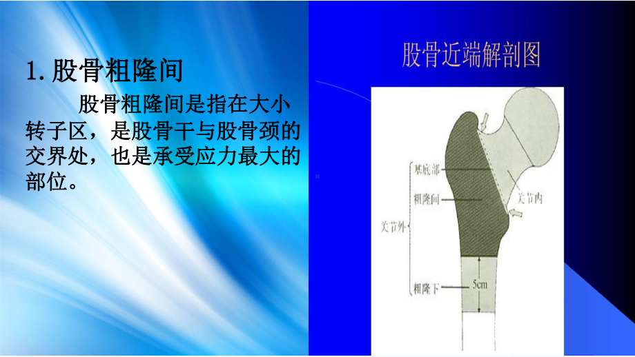 股骨粗隆间骨折分型-PPT课件.ppt_第3页