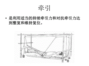 如小儿股骨干骨折用垂直悬吊皮牵引课件.ppt