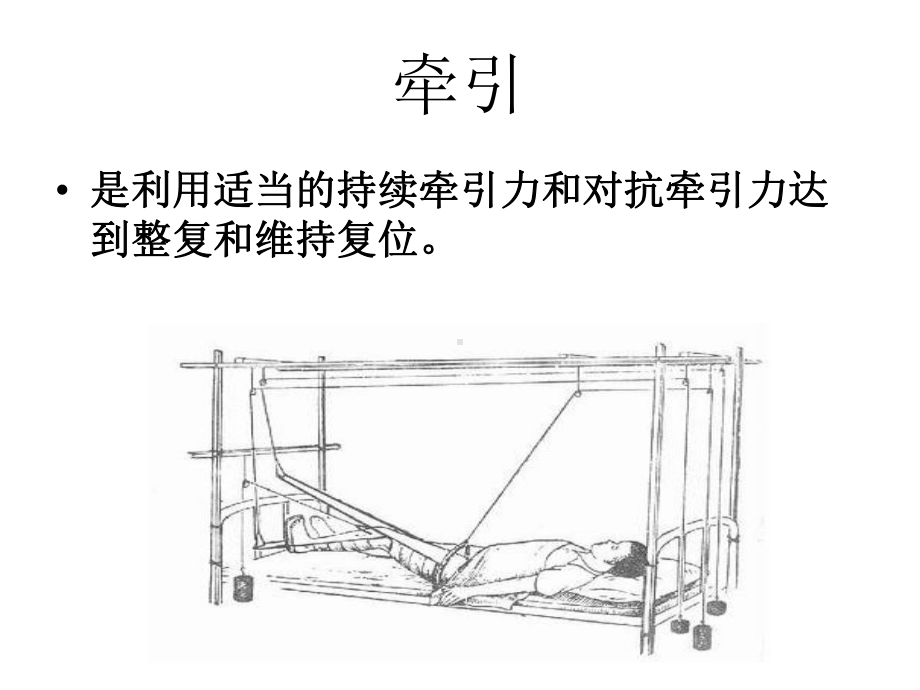 肱骨髁上骨折用邓乐普牵引课件.ppt_第1页