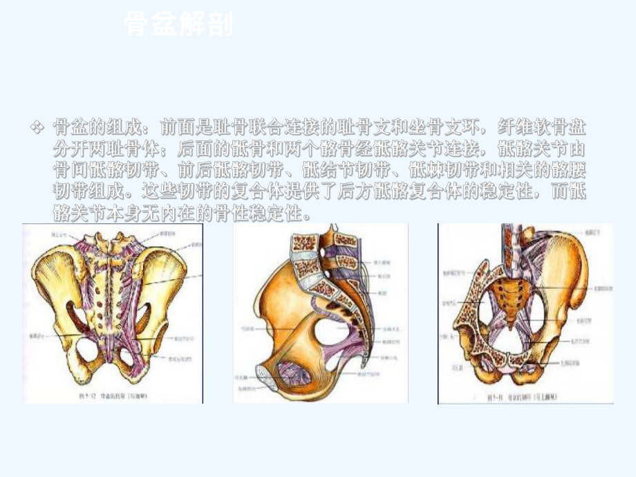 骨盆骨折分型及治疗课件.ppt_第3页