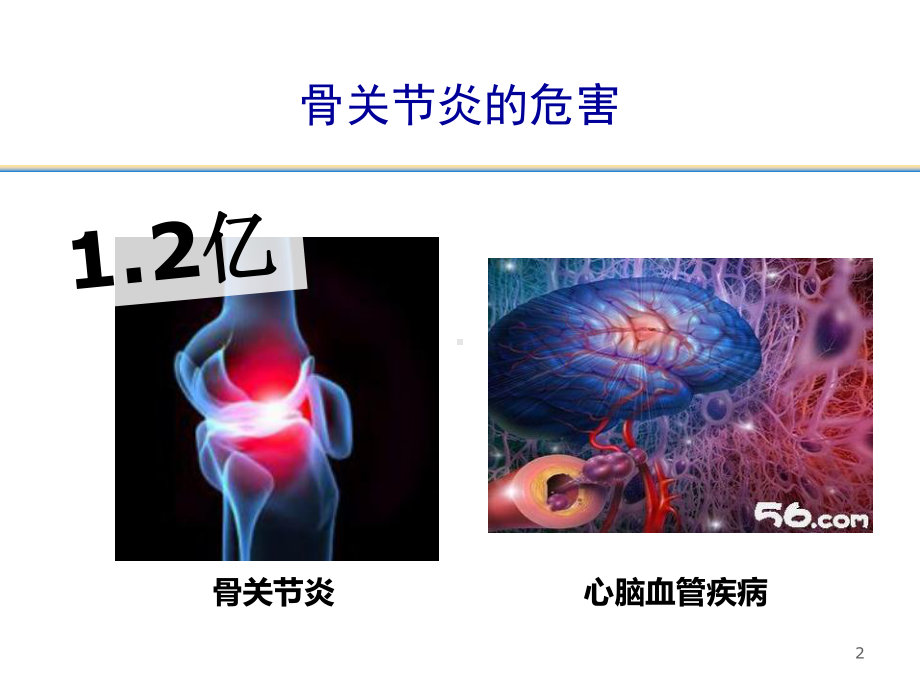 双醋瑞因的软骨保护作用-ppt课件.ppt_第2页