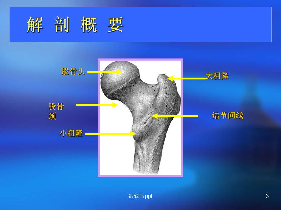 股骨颈骨折护理PPT课件1.ppt_第3页