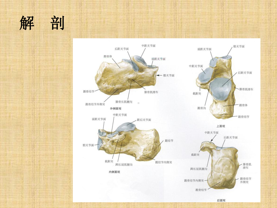 跟骨骨折的手术治疗1课件.ppt_第3页