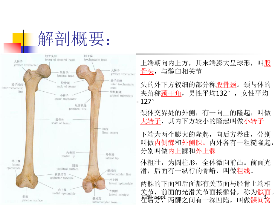 股骨骨折PPT课件.pptx_第3页