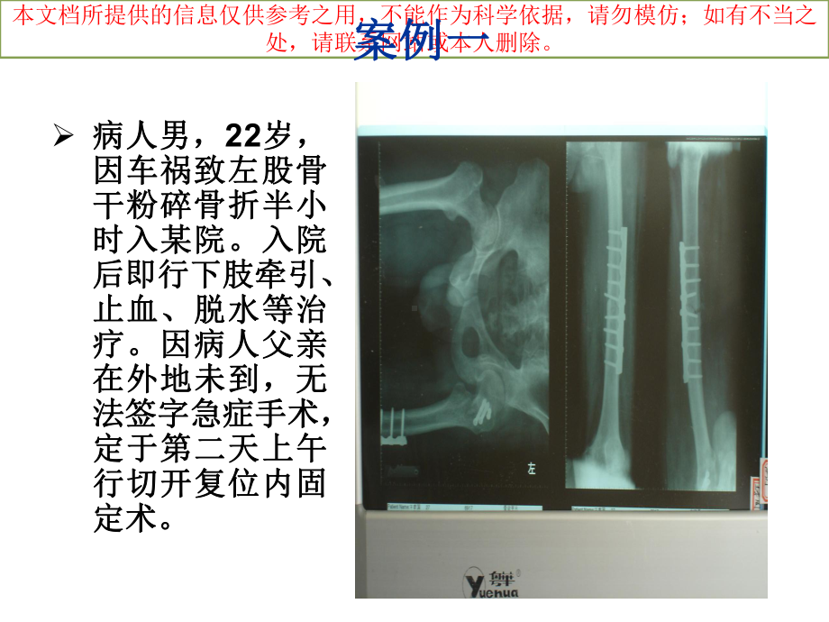 骨科医疗纠纷案例分析培训课件.ppt_第3页