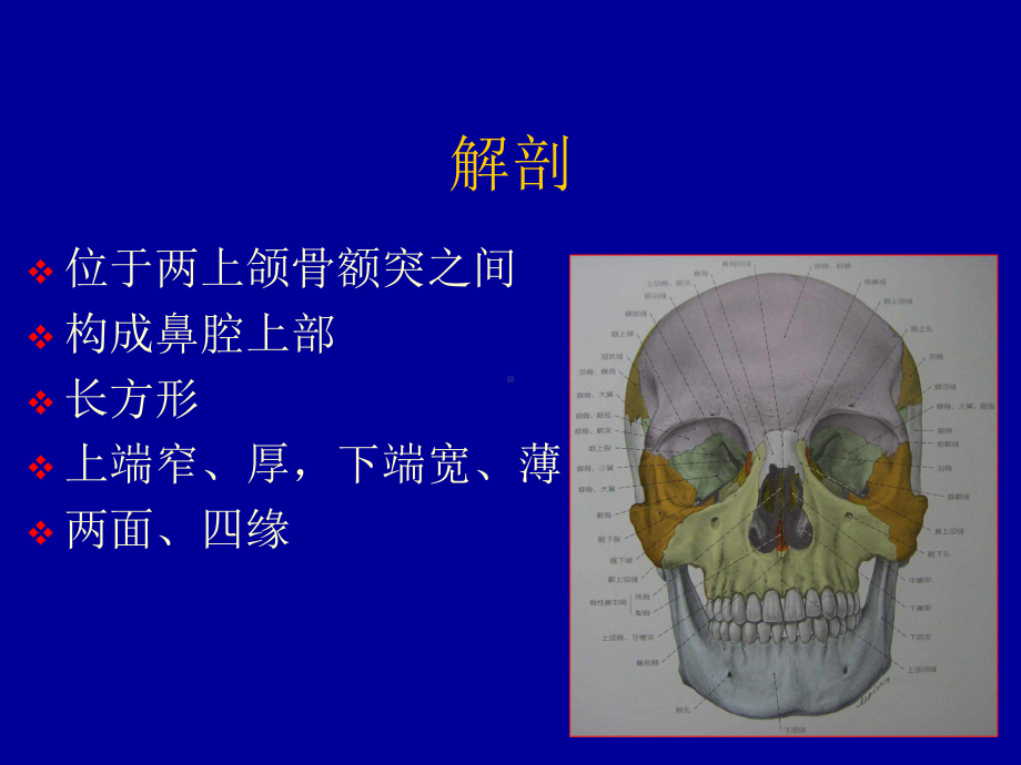 鼻骨骨折影像学诊断PPT课件.ppt_第2页