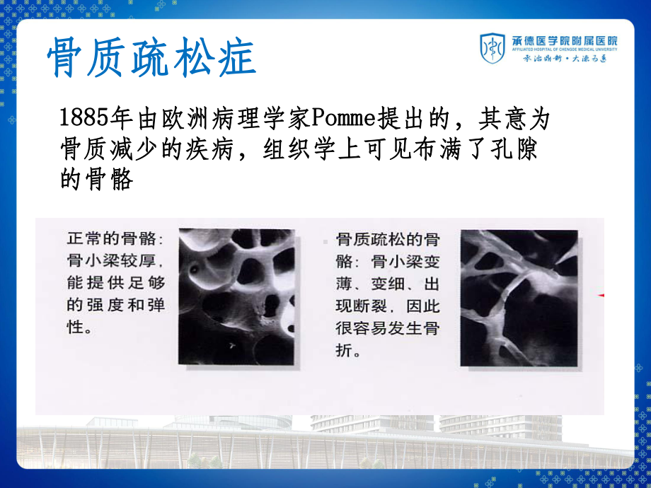 骨质疏松症与骨密度PPT课件.ppt_第3页