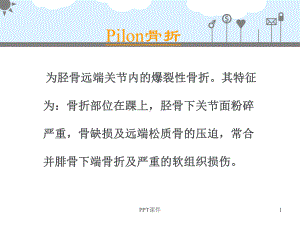 Pilon骨折-ppt课件.ppt