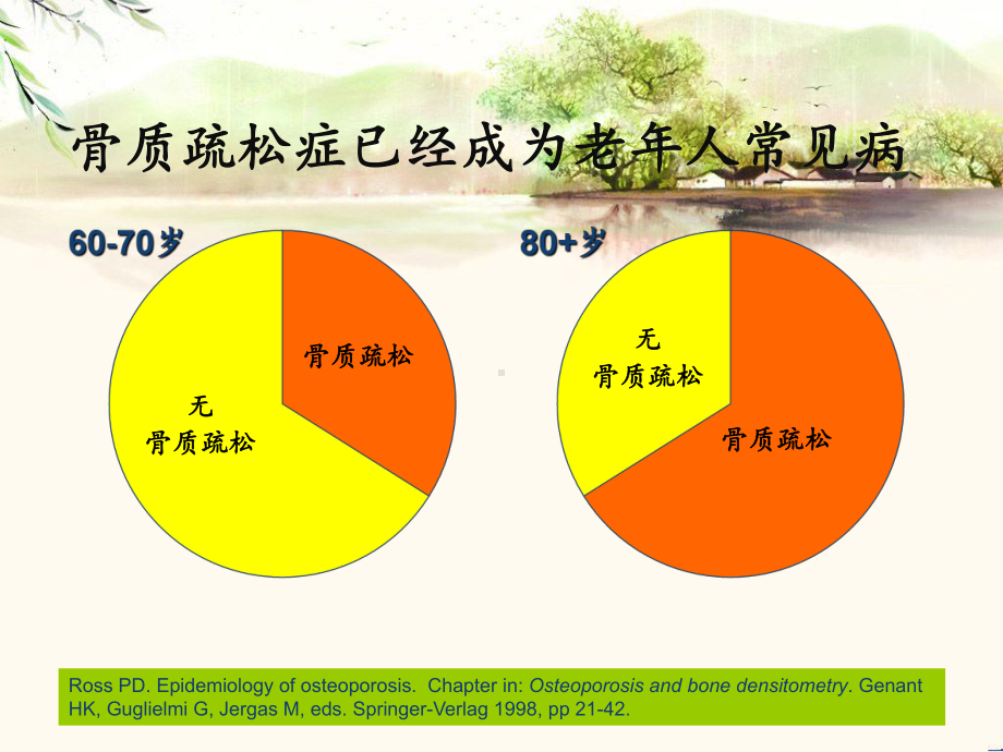 骨质疏松与疼痛-ppt课件.ppt_第2页