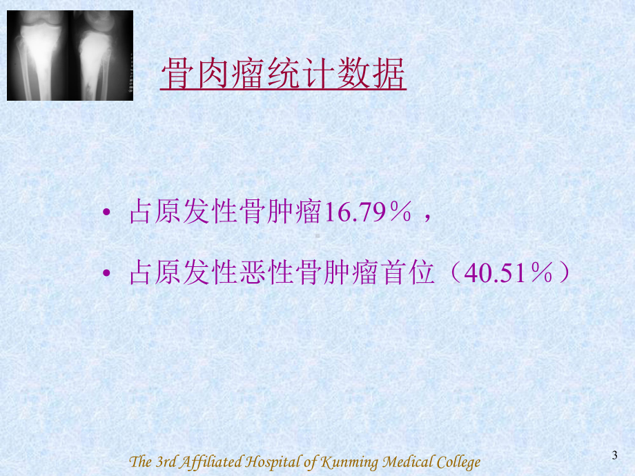 骨肉瘤(Osteosarcoma)-课件.ppt_第3页