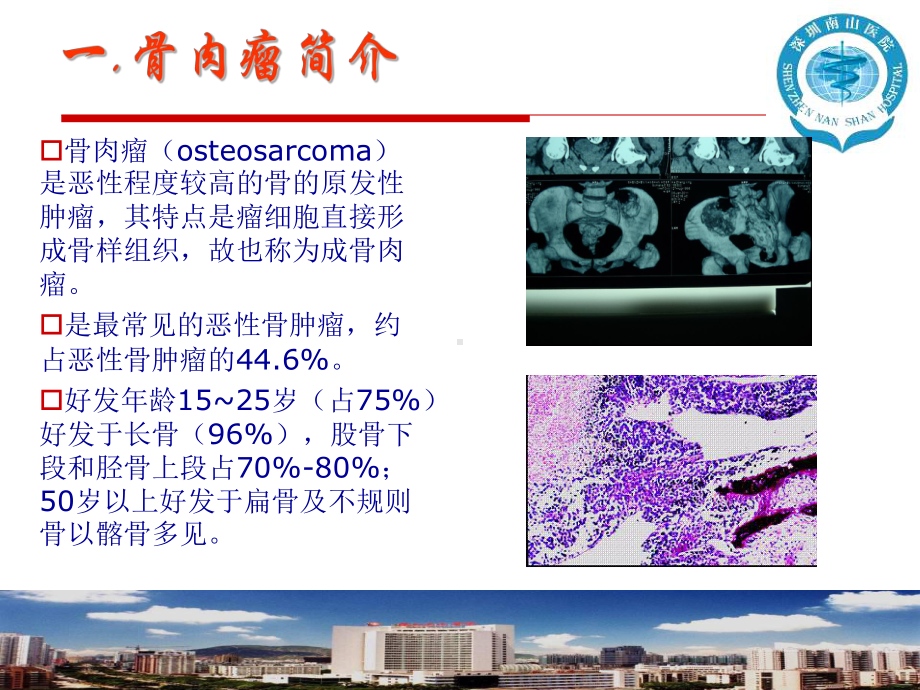 骨肉瘤新辅助化疗课件.ppt_第3页