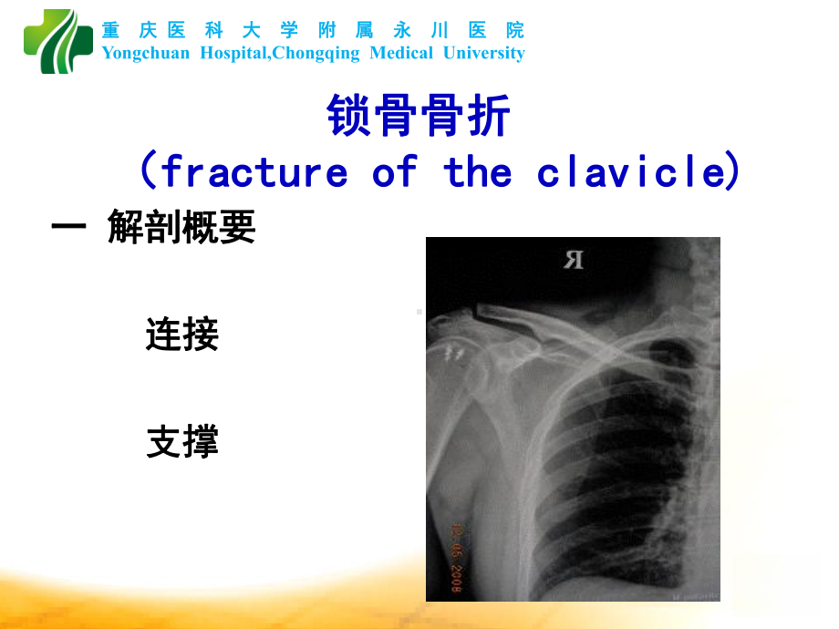 上肢骨折脱位课件.ppt_第2页