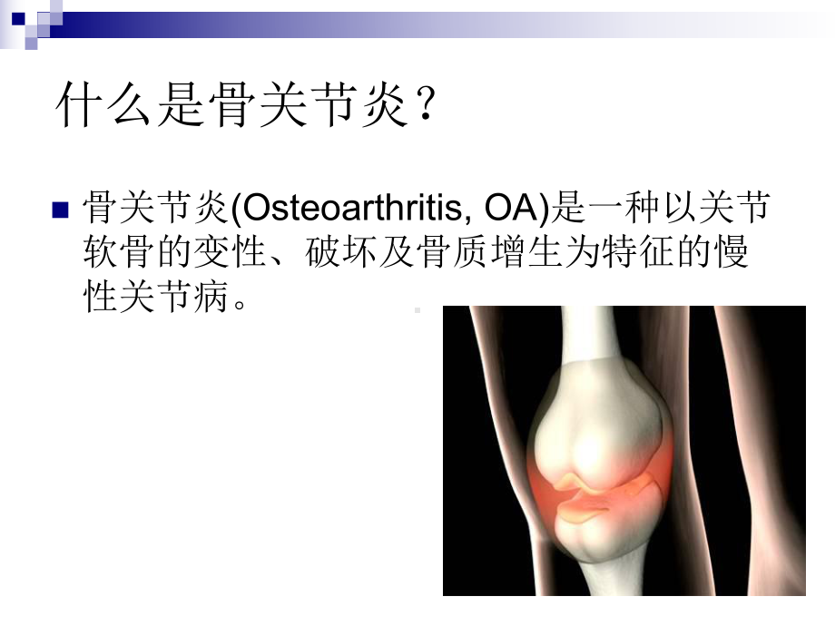 骨关节炎的预防和康复课件.ppt_第2页