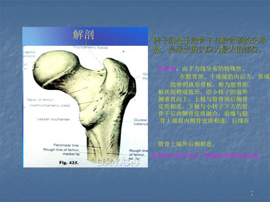 股骨转子间骨折的分型与治疗PPT课件.ppt_第2页