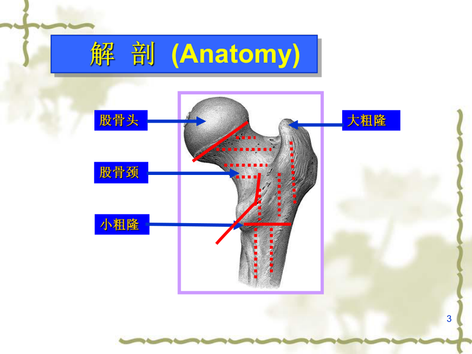 股骨颈骨折护理PPT课件.ppt_第3页