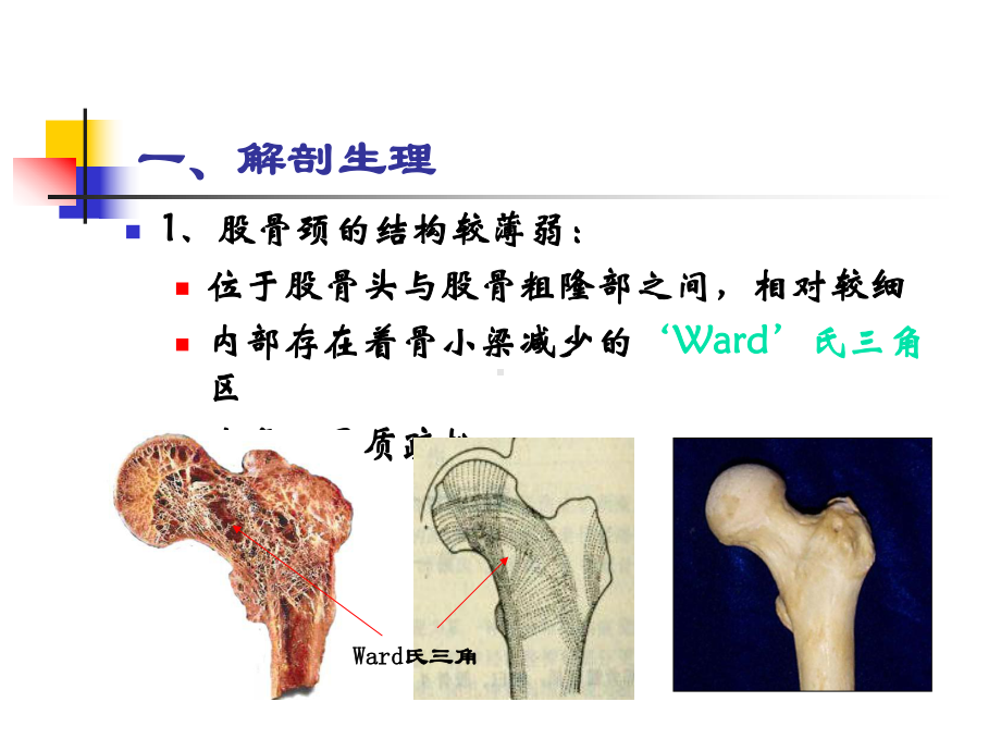 股骨颈骨折概述课件.ppt_第2页