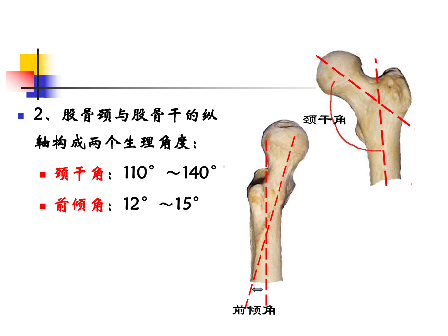 股骨颈骨折概述课件.ppt_第3页