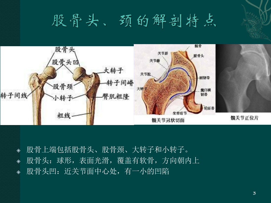 股骨头缺血性坏死PPT课件.ppt_第3页