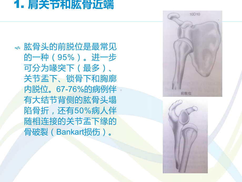 骨折与脱位诊断分型及治疗-ppt课件.ppt_第2页