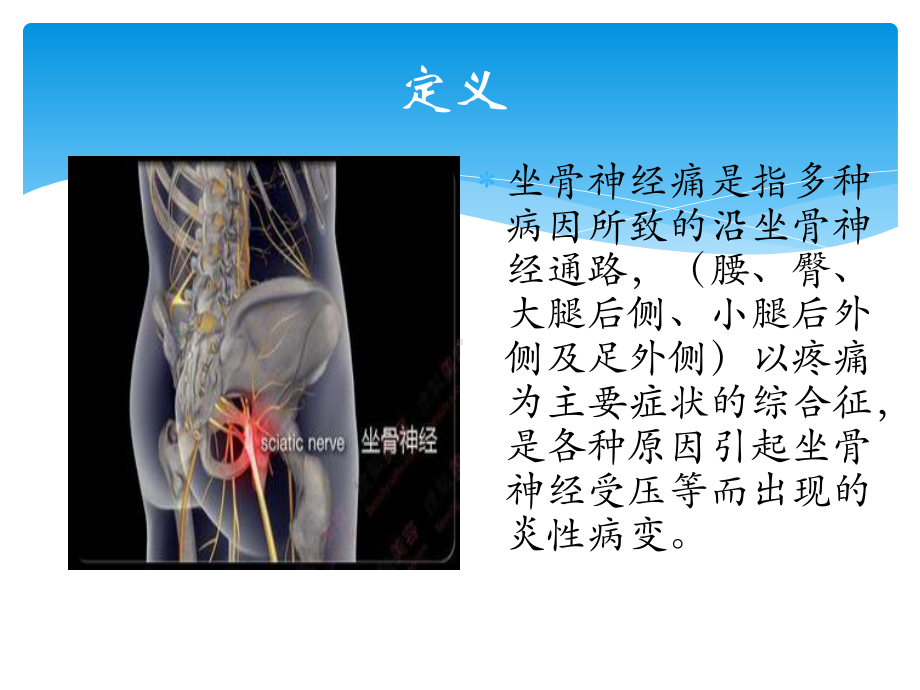 坐骨神经痛及治疗课件.pptx_第3页