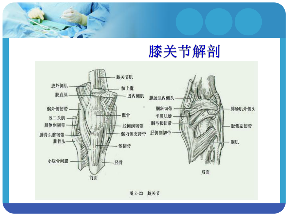 膝关节骨性关节炎ppt课件.ppt_第3页