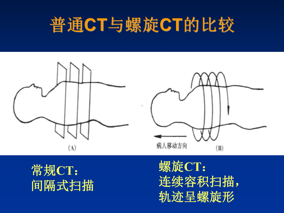 田氏西门子16排螺旋CT后处理技术的骨科应用课件.ppt_第3页