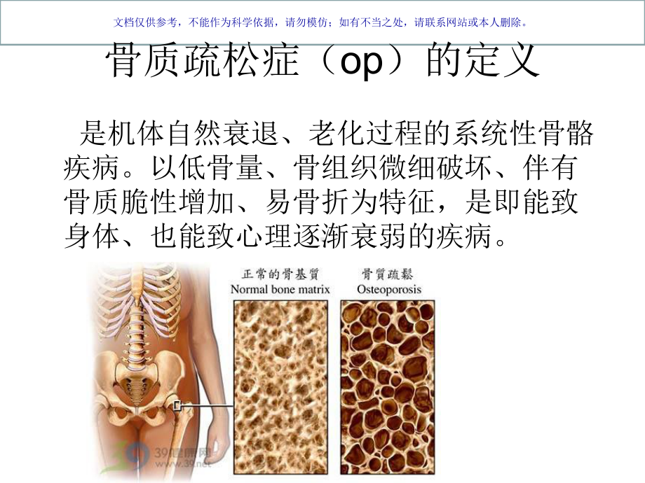 骨科月份业务学习课件.ppt_第2页