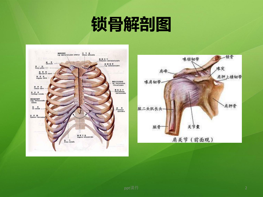 锁骨骨折护理查房-ppt课件.pptx_第2页