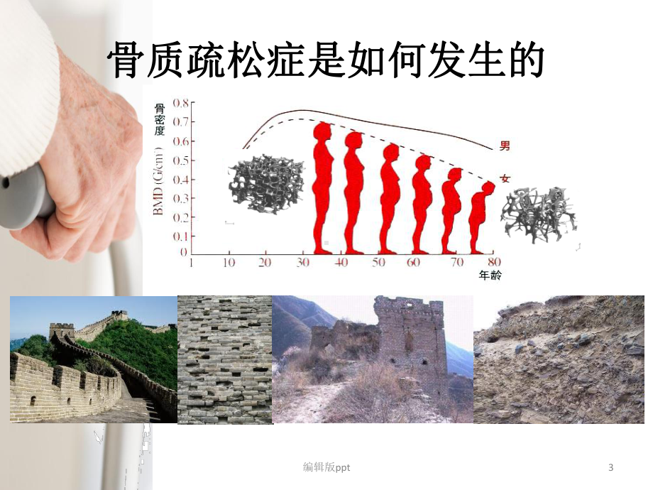 骨质疏松症患者教育PPT课件.ppt_第3页