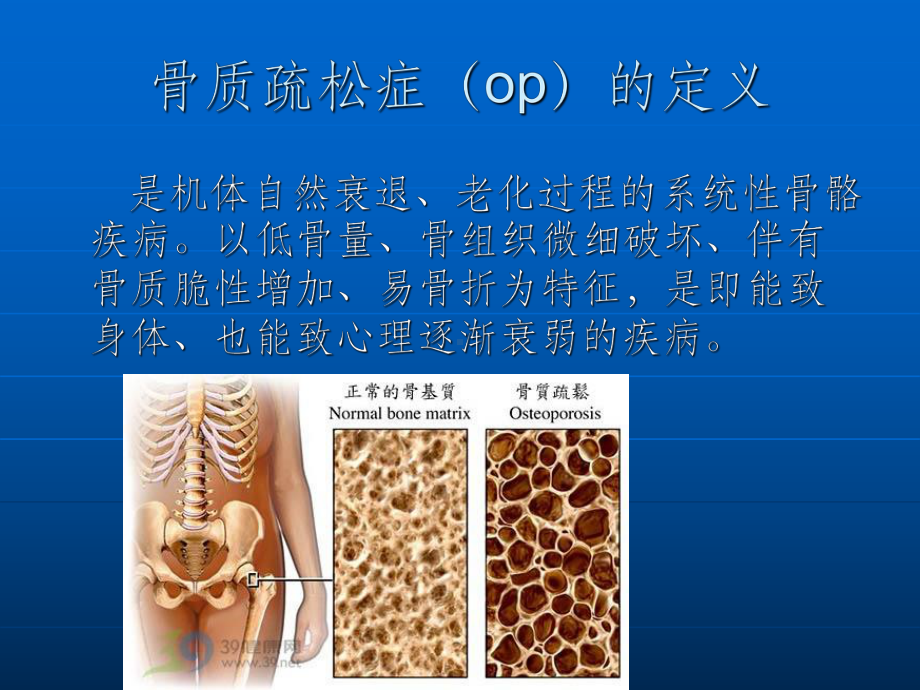 骨科份业务学习ppt课件.ppt_第3页