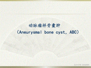 动脉瘤样骨囊肿PPT医学课件.ppt