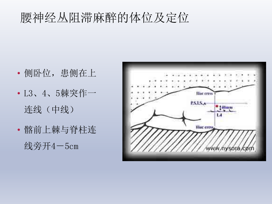 骨科手术的麻醉ppt课件.ppt_第3页