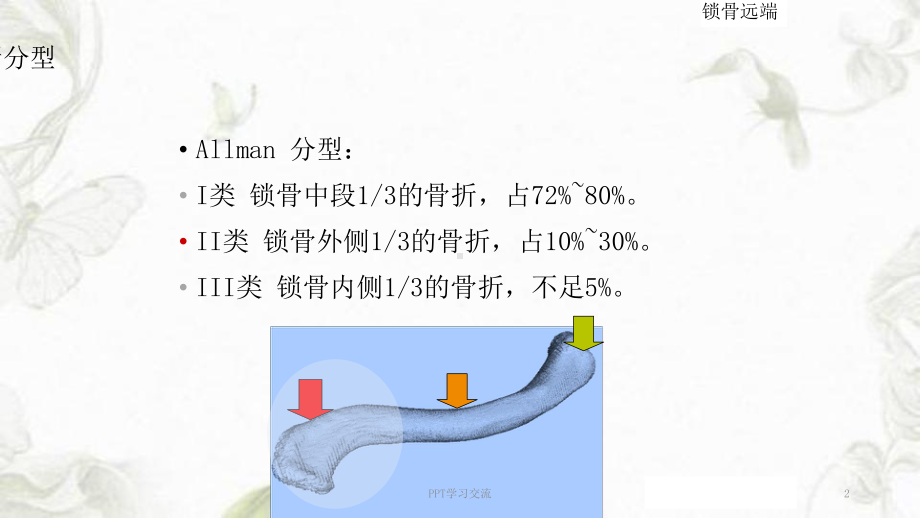 锁骨远端骨折PPT课件.ppt_第2页