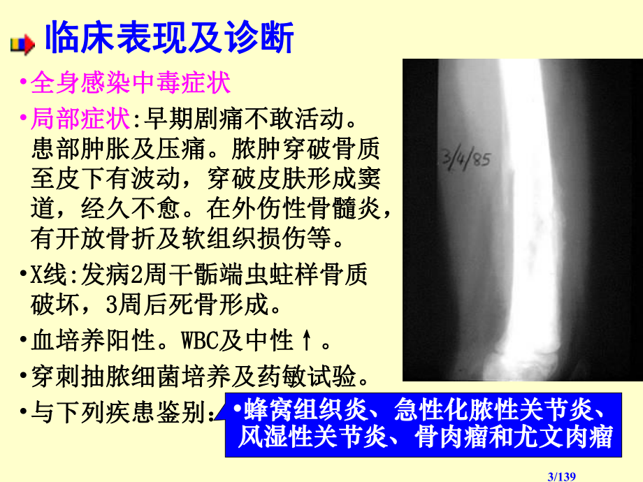 骨感染骨肿瘤Bone-Infections-Tumor-PPT课件.ppt_第3页