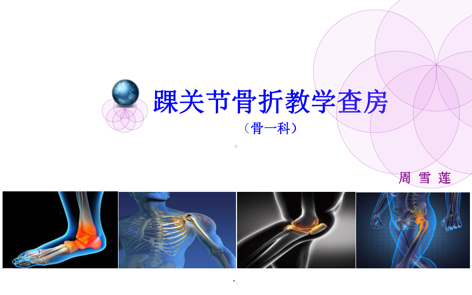 踝关节骨折ppt课件2.ppt_第1页